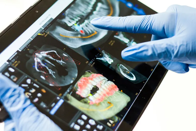 Digitaler Workflow in der Zahntechnik